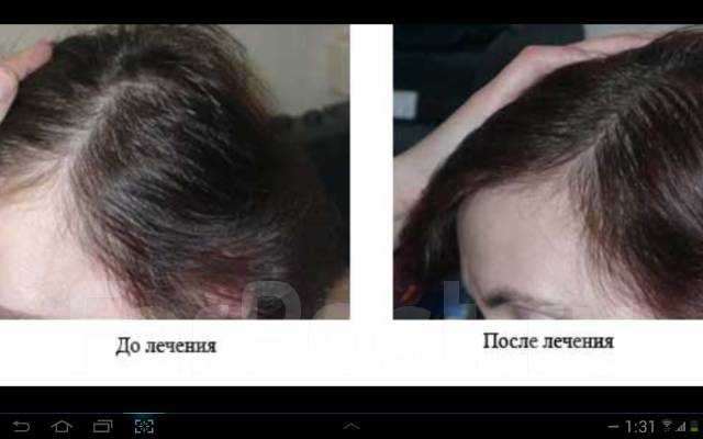 Обновление волос на голове сколько длится у женщин