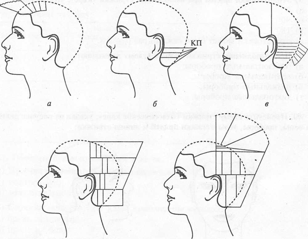 Градуировка нижней затылочной зоны горизонтальными проборами схема. Градуированная форма стрижки схема формы. Градуировка нижней затылочной зоны вертикальными проборами схема. Градуированная форма стрижки технология выполнения.