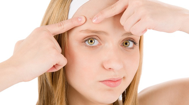 Гормональные изменения в подростковом возрасте могут вызвать поредение и выпадение волос у девочек