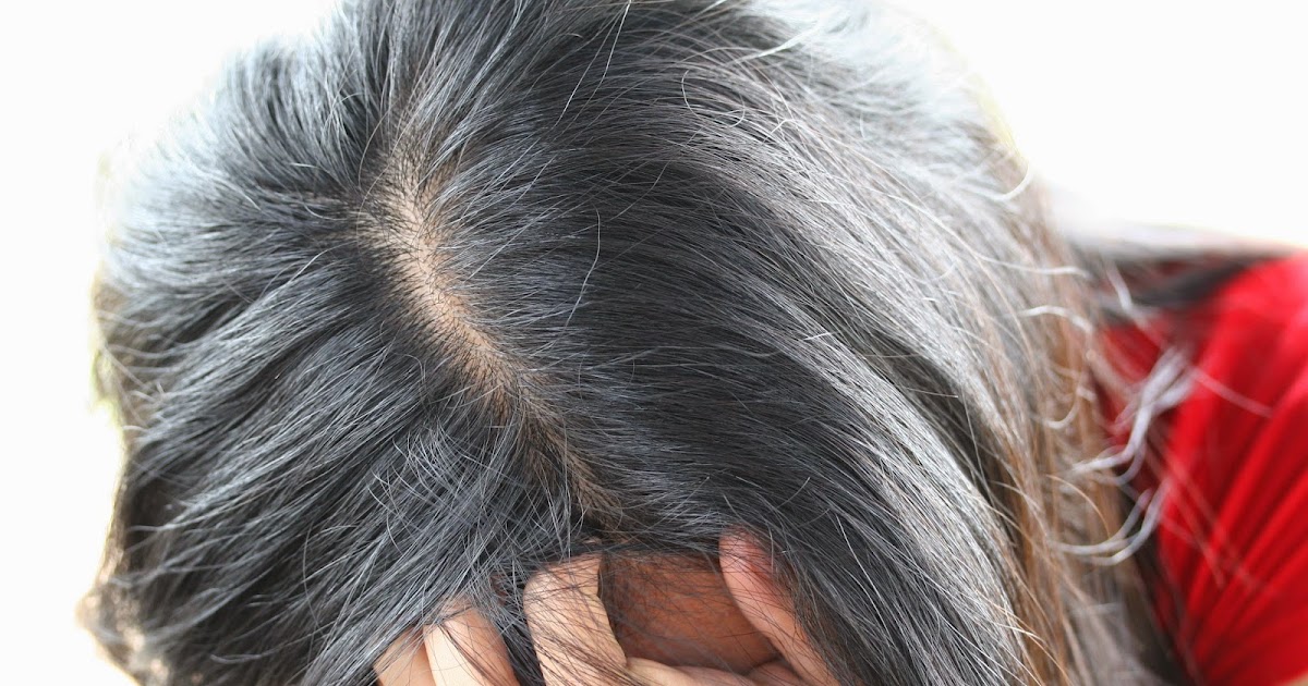 Появился первый седой волос. Причины седых волос у детей 1 года. Ранняя Седина у подростков мальчиков частями.