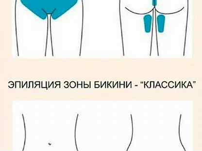Бикини классическое шугаринг схема