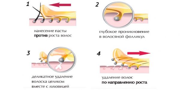 Шугаринг детально