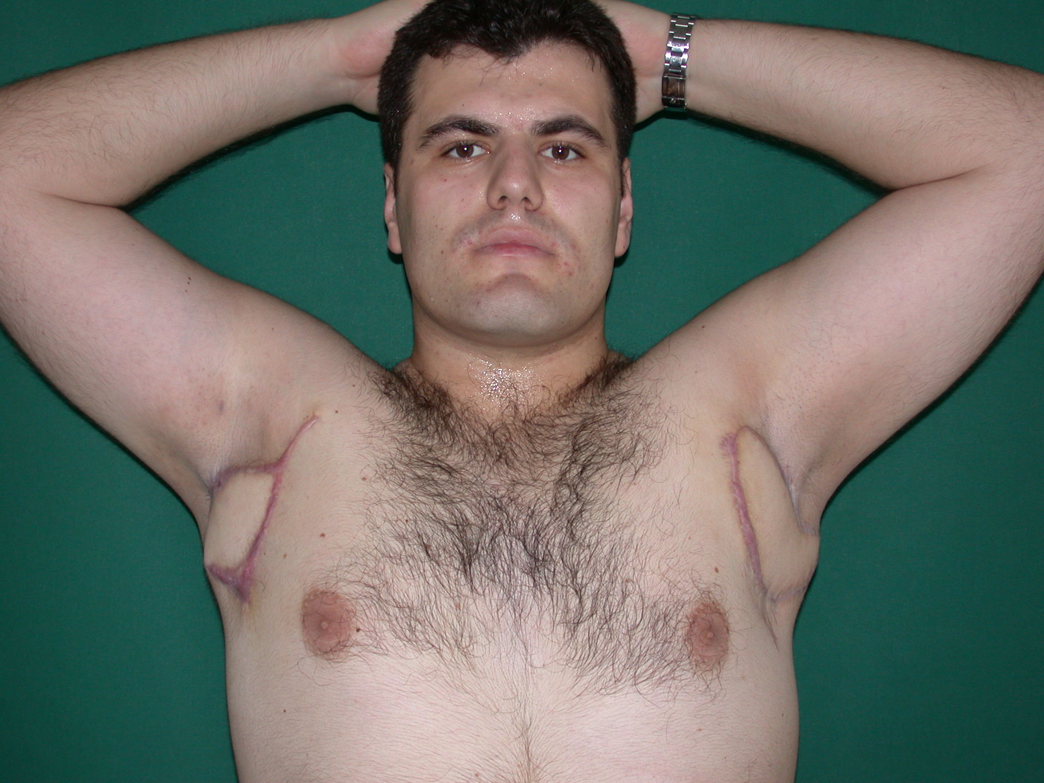 волосы на груди у мужчин врач фото 98