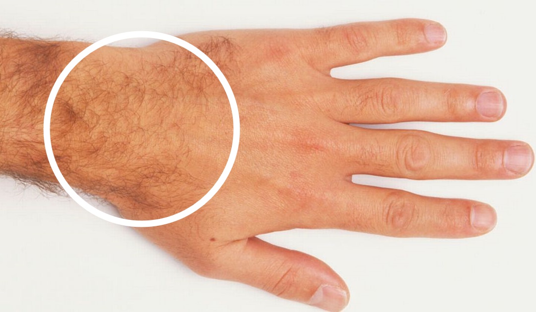 Как избавиться от волос на пальцах рук у мужчин