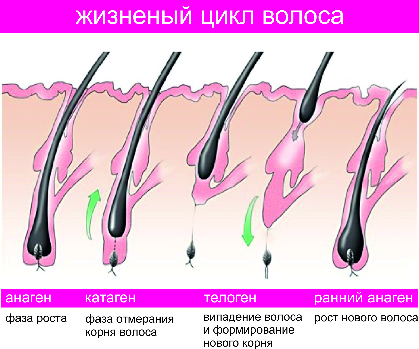Как прекратить рост луковицы волос
