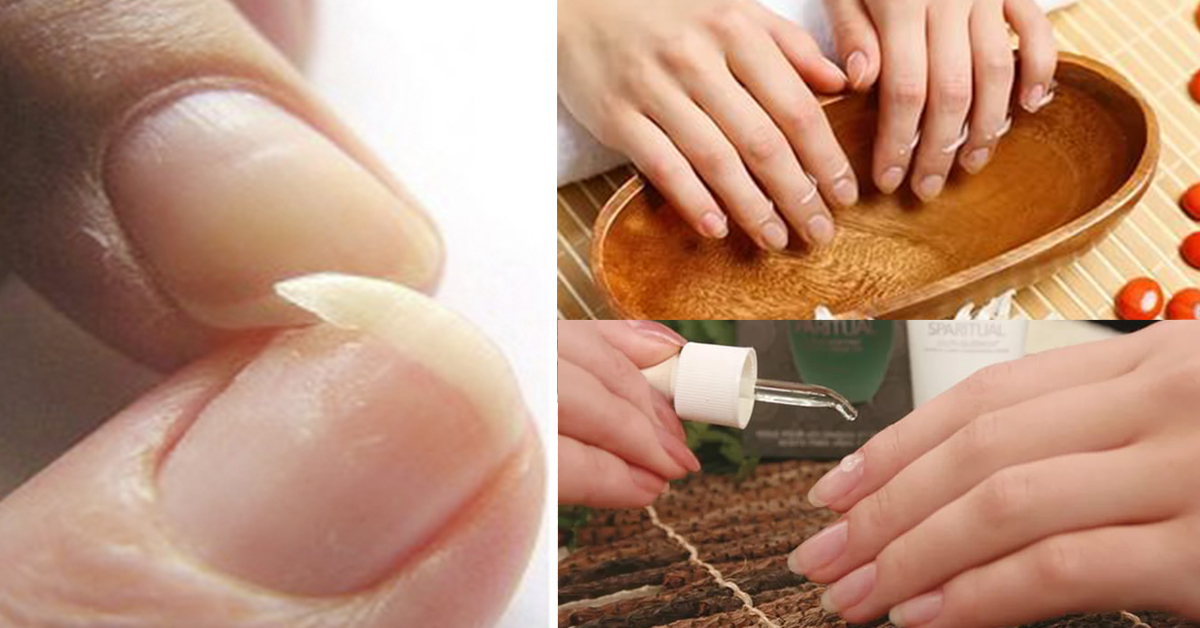 Ногти тонкие мягкие что делать. Укрепление ногтей. Укрепить слоящиеся ногти. Гель для слабой ногтевой пластины. Способы укрепления ногтевой пластины.