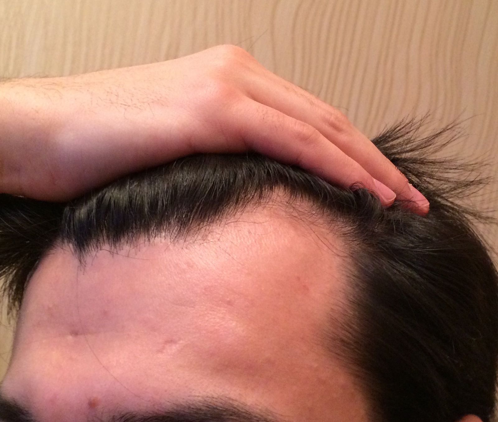 Плотный волос на голове