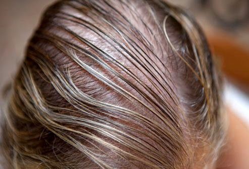 Поиск причин выпадения волос