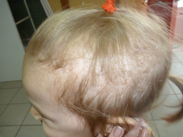 Ребенок постоянно крутит волосы на голове с чем это связано