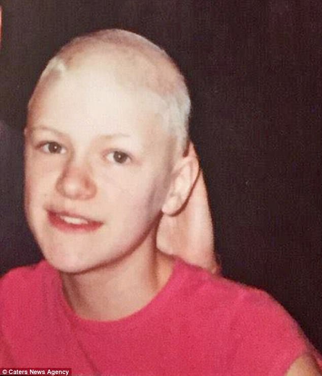 Corinne was diagnosed with the autoimmune disease at 10 years old and within a month was completely bald. Doctors said her hair would never grow back