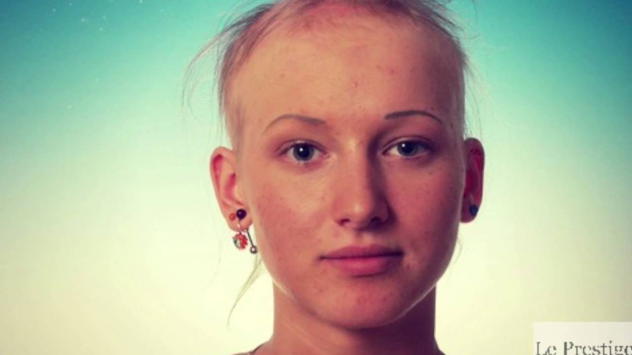 Какие волосы после химиотерапии