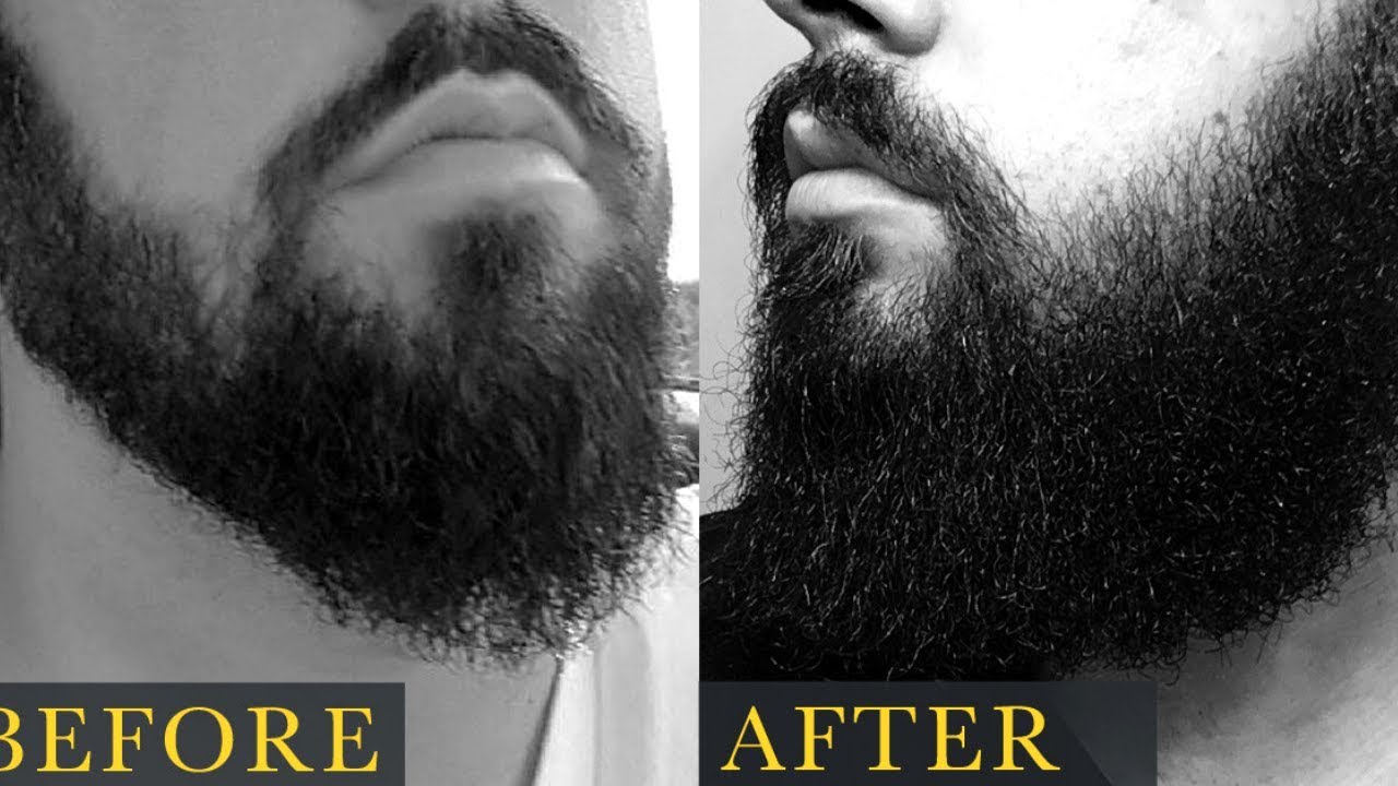 Como hacer que te crezca la barba