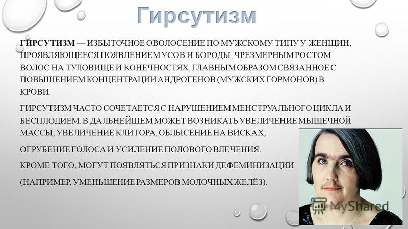 Повышенные андрогены у женщин. Оволосение по женскому типу и мужскому типу. Jdjkjctybtybt GJ ve;crjve b ;tycrjve NBGE.