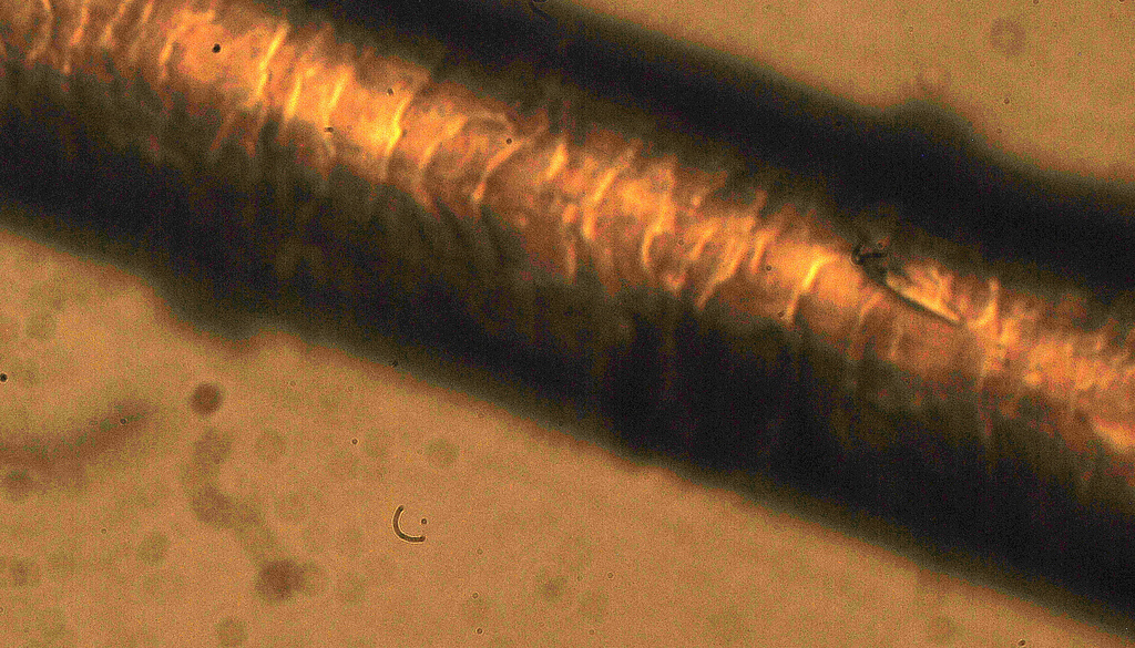 Фото волосы под микроскопом фото