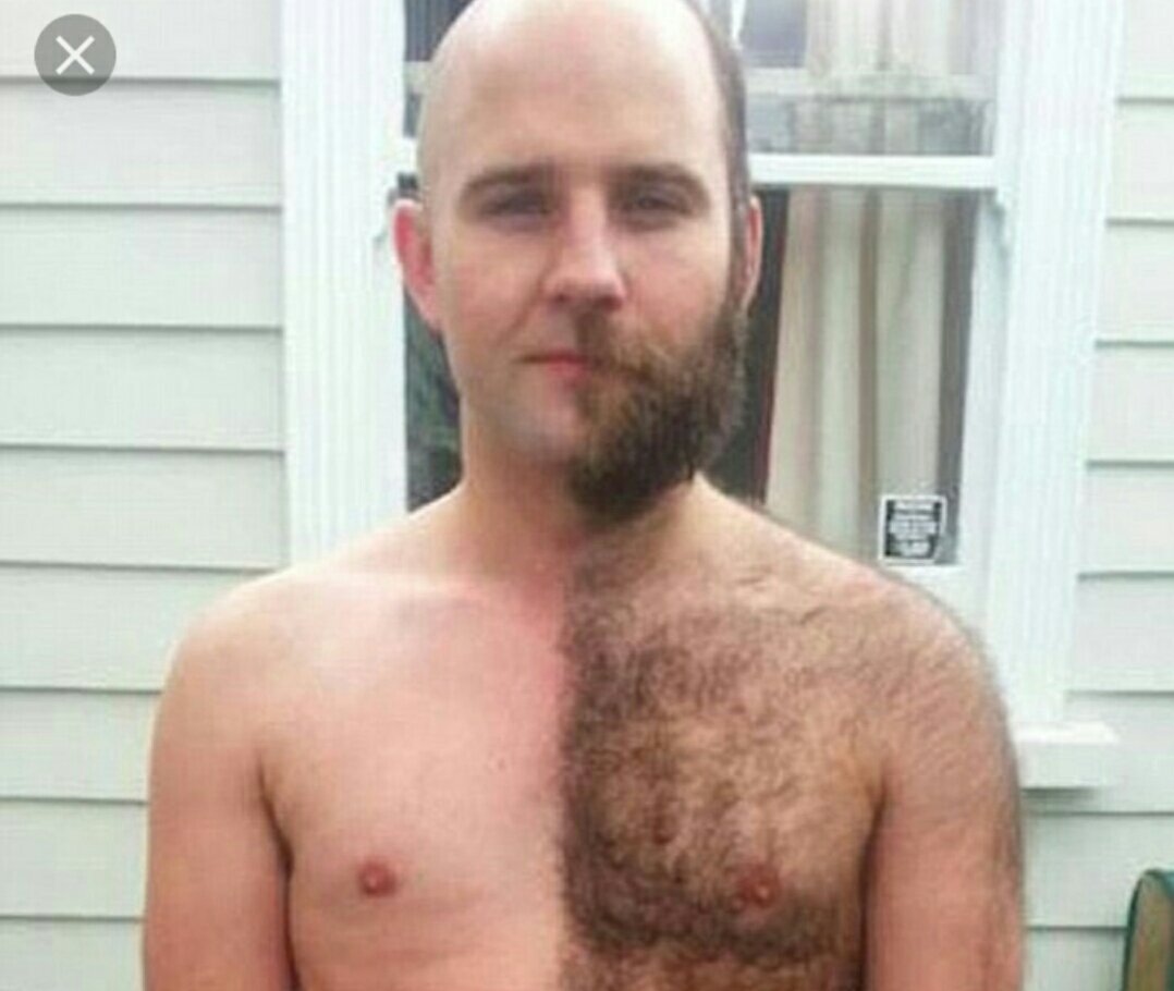волосы на животе и груди у мужчин фото 78