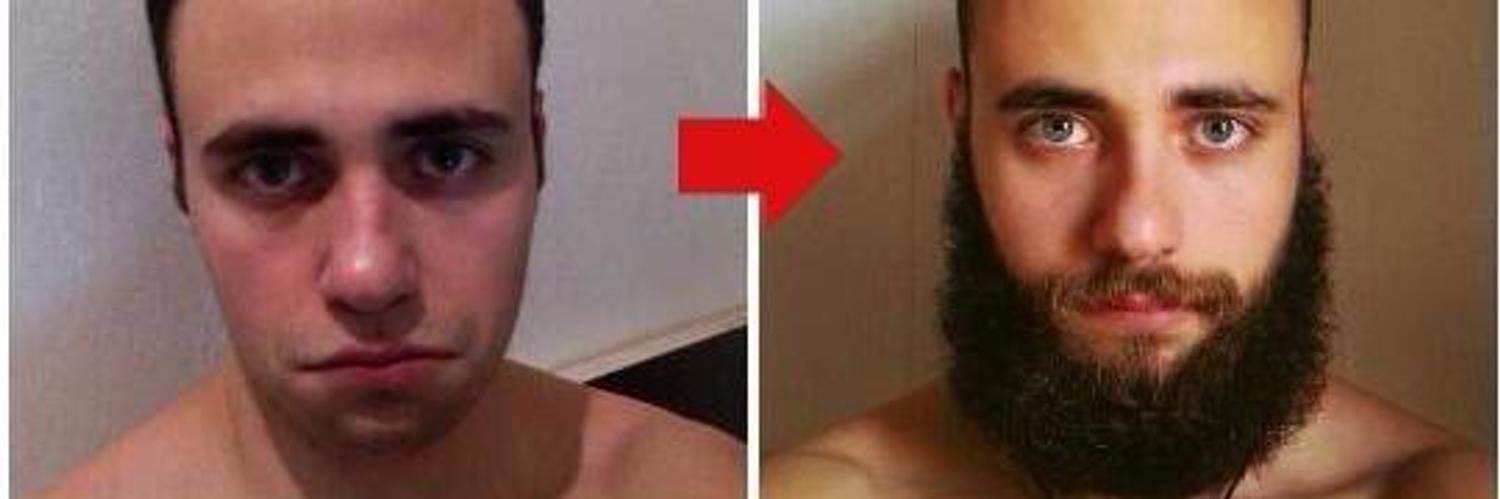 Рост волос на лице у мужчин. Этапы отращивания бороды. Этапы роста бороды. Отрастить бороду. Борода через три месяца.