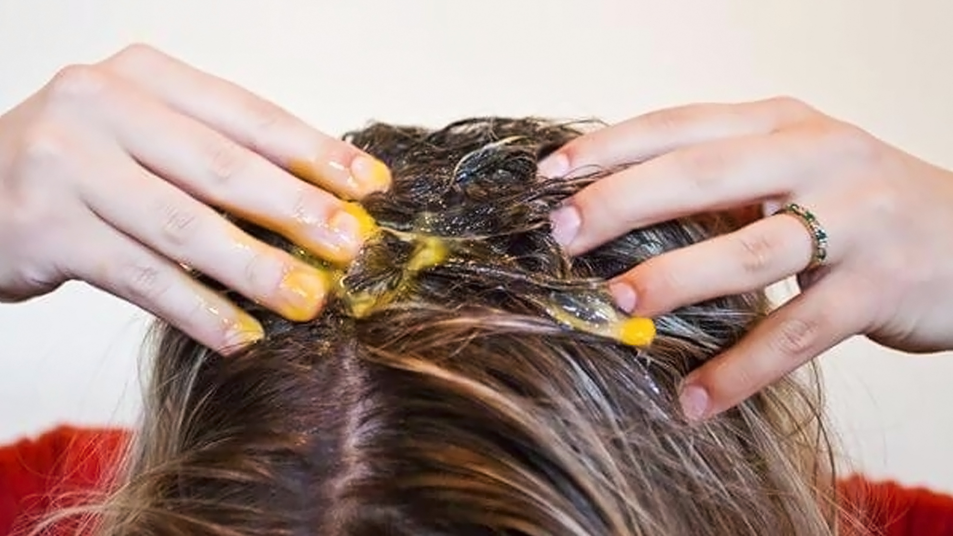 Витамин в мытье головы выпадение волос