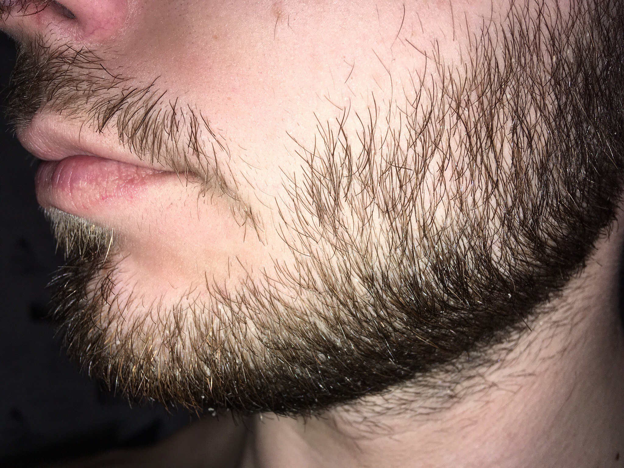 Почему борода называется бородой