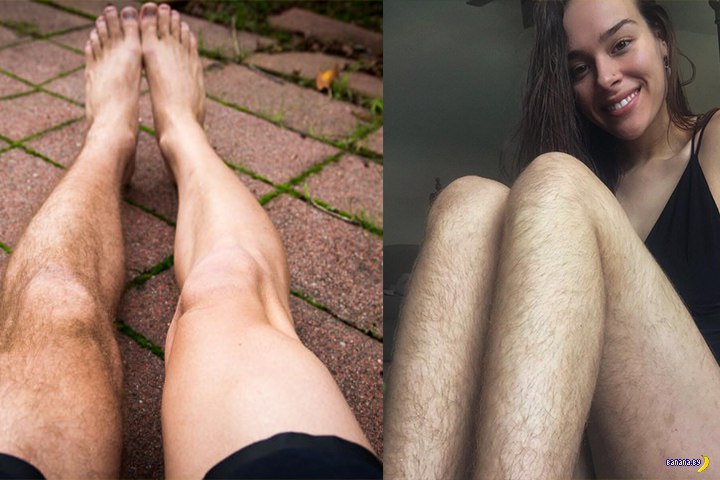 Почему на ногах так много волос у девочки