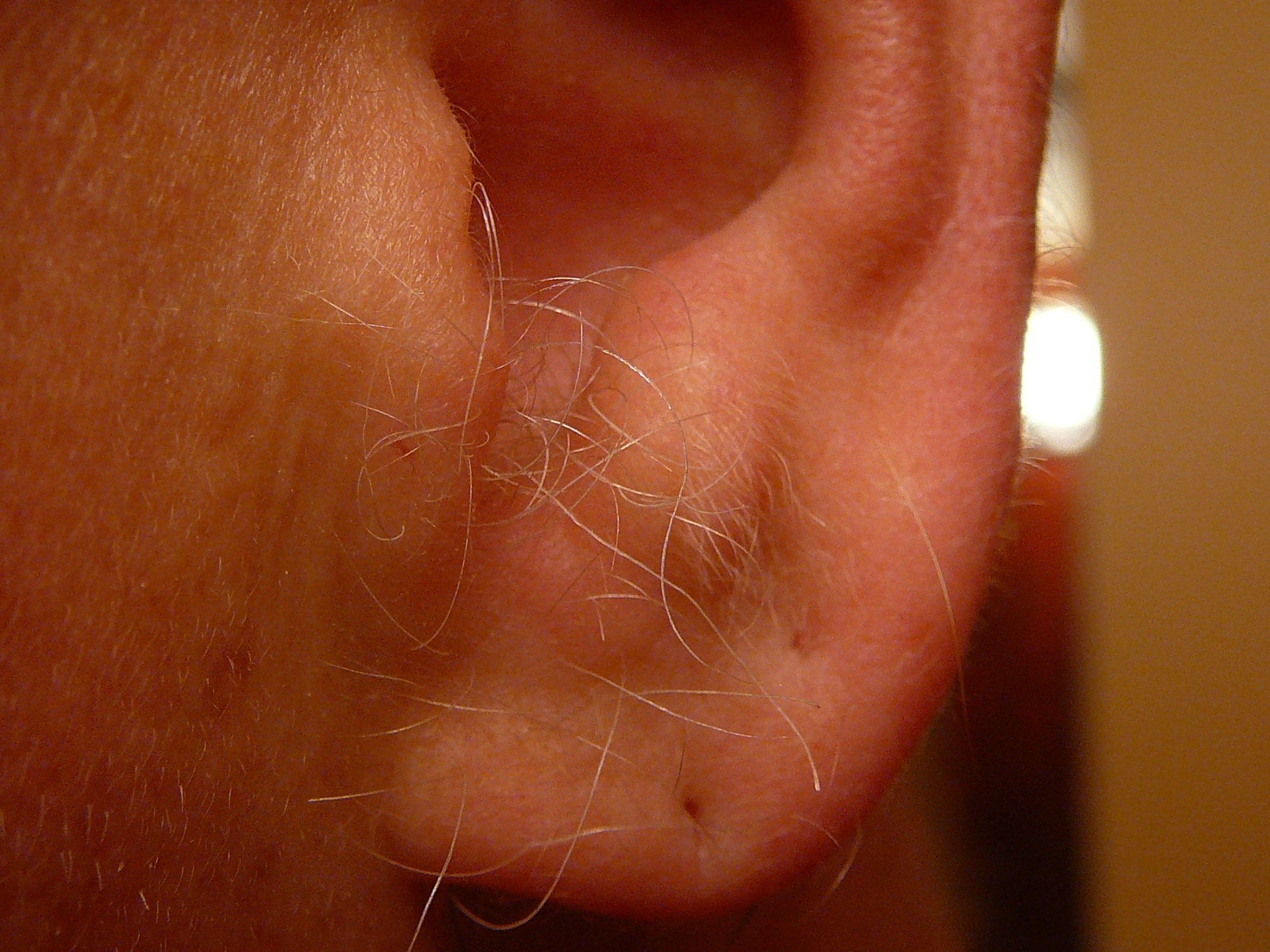 Волосы на ушах у мужчин. Гипертрихоз ушной раковины. Гипертрехоз ушные раковины.