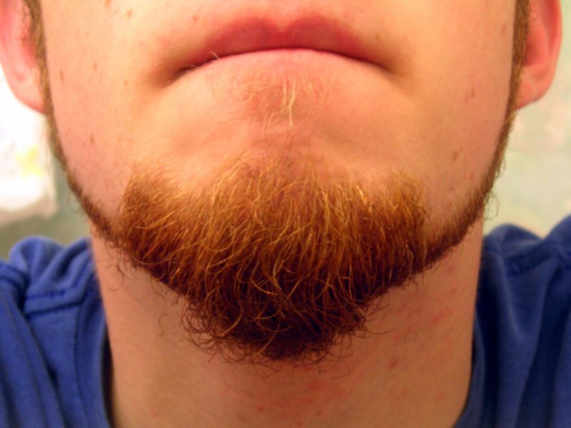 Почему не растет борода под нижней губой