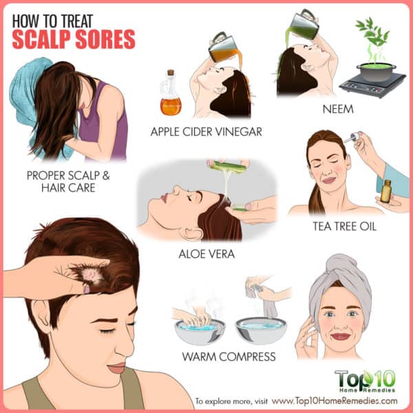 How to treat scalp sores