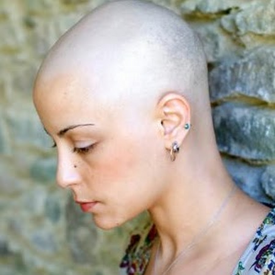 Фото как растут волосы после химиотерапии
